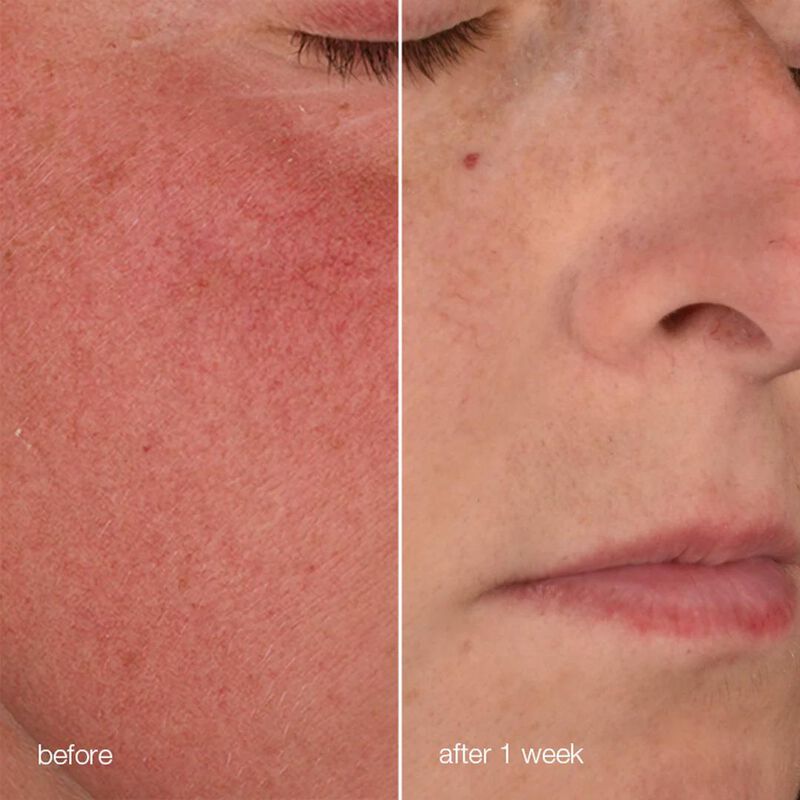 Dermalogica Stabilising Repair Cream 50ml image number 3