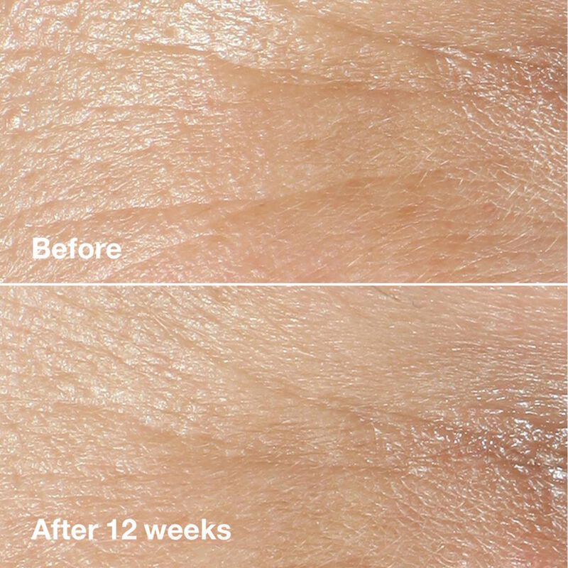 Clinique Smart Clinical Repair Wrinkle Correcting Cream 50ml image number 1