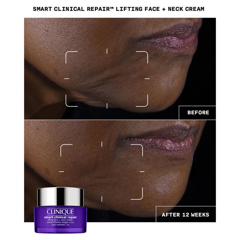 Clinique Smart Clinical Repair Lifting Face + Neck Cream 50ml image number 2