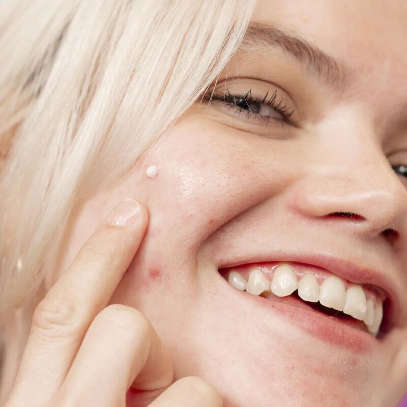 Dermalogica Clear Start Post-Breakout Fix 15ml image number 2