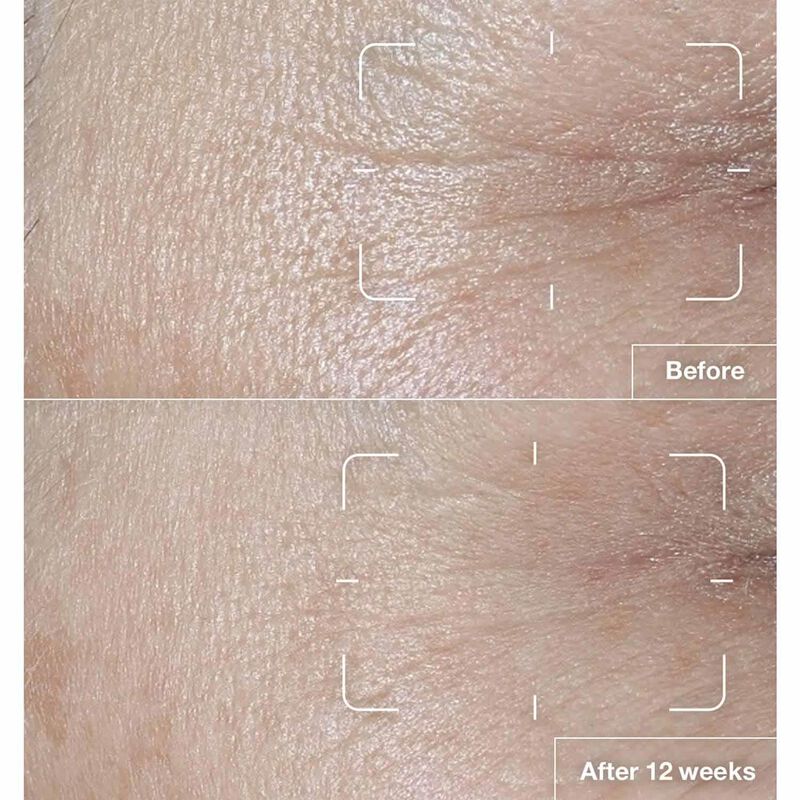 Clinique Smart Clinical Repair SPF 15 Wrinkle Correcting Cream image number 2