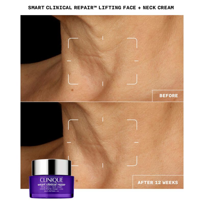 Clinique Smart Clinical Repair Lifting Face + Neck Cream 50ml image number 3