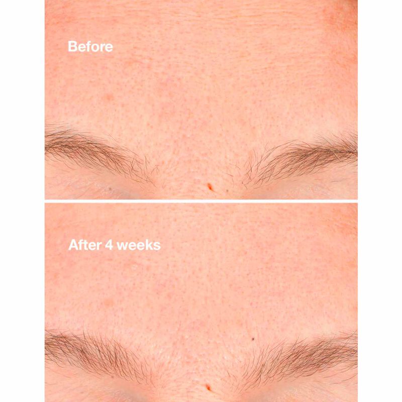 Clinique Clarifying Micro Peel 30ml image number 2